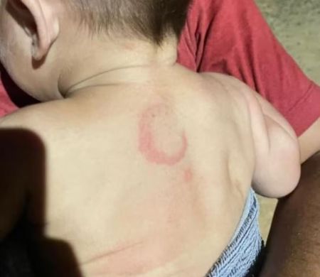 Bebê de 4 meses é agredido e pai é preso como suspeito em Campo Grande