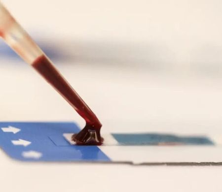 Pesquisa inédita da Fiocruz amplia estratégias contra HIV em jovens&nbsp;