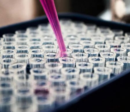 Pesquisas avançam no diagnóstico de Alzheimer no Brasil 