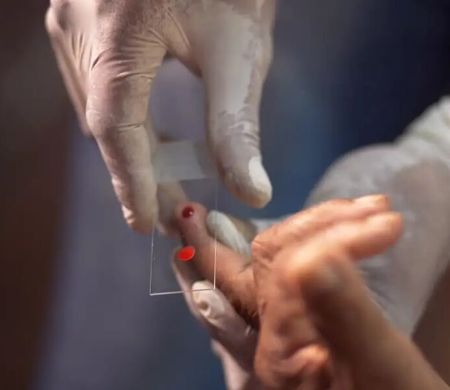 Novo tratamento contra malária para crianças começa a ser adotado pelo SUS